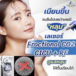 โปรรักษาหลุมสิว