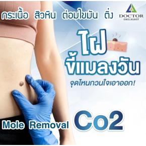 โปรเลเซอร์จี้ไฝ เหมาทั่วหน้า คุ้มสะใจ