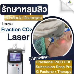 ใหม่ โปรเลเซอร์ผีลืมหลุม