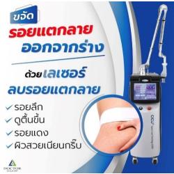 Bye Bye Zebra บอกลารอยแตกลาย !!